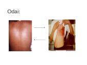 Druskos rūgštis 7 puslapis