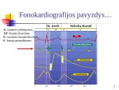 Elektrokardiografija (EKG)