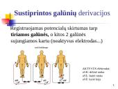Elektrokardiografija (EKG) 13 puslapis