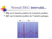 Elektrokardiografija (EKG) 17 puslapis