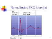 Elektrokardiografija (EKG) 18 puslapis