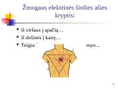Elektrokardiografija (EKG) 6 puslapis