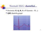 Elektrokardiografija (EKG) 7 puslapis