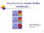 Elektrokardiografija (EKG) 9 puslapis