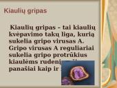 Kiaulių gripas 2 puslapis