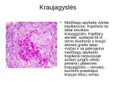 Kraujotakos sistema 5 puslapis