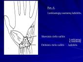 Plaštakos anatomija 12 puslapis