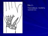 Plaštakos anatomija 15 puslapis