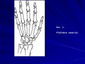 Plaštakos anatomija 4 puslapis