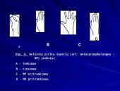 Plaštakos anatomija 10 puslapis