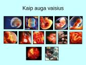 Prenatalinis periodas 13 puslapis