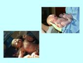 Prenatalinis periodas 17 puslapis