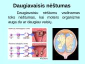 Prenatalinis periodas 4 puslapis