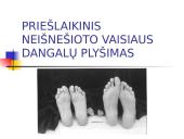 Priešlaikinis neišnešioto vaisiaus dangalų plyšimas