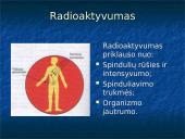 Radioaktyvumo poveikis žmogui 3 puslapis