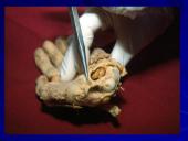 Riešo sąnarys 17 puslapis