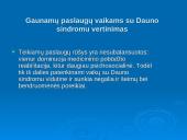 Socialinio darbuotojo veikla, dirbant su Dauno sindromą turinčiais asmenimis 10 puslapis