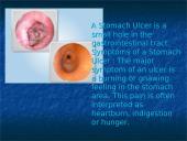 The Stomach 6 puslapis