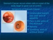 The Stomach 7 puslapis