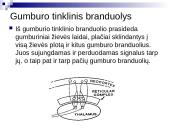 Tinklinio darinio įtaka sensorinėms ir motorinėms funkcijoms 12 puslapis