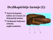 Žmogaus virškinimo sistemos organai 11 puslapis