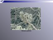 Virusų, bakterijų, protistų ir grybų praktinė reikšmė 18 puslapis