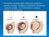 Žmogaus dauginimasis 10 puslapis