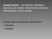 Cezario pjūvis 2 puslapis