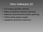 Cezario pjūvis 11 puslapis