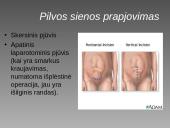 Cezario pjūvis 15 puslapis