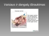 Cezario pjūvis 17 puslapis