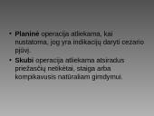 Cezario pjūvis 3 puslapis