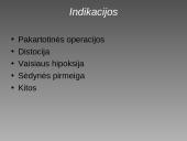 Cezario pjūvis 4 puslapis