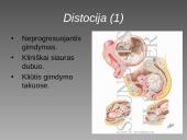 Cezario pjūvis 6 puslapis