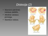 Cezario pjūvis 7 puslapis
