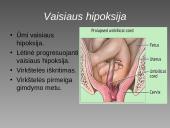 Cezario pjūvis 8 puslapis