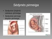 Cezario pjūvis 9 puslapis