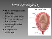 Cezario pjūvis 10 puslapis