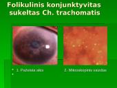 Chlamidijos 8 puslapis