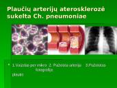 Chlamidijos 9 puslapis