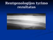 Dujinė gangrena 15 puslapis