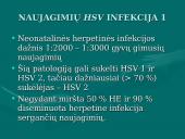 Herpes simplex virusas 16 puslapis