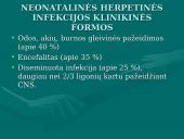 Herpes simplex virusas 18 puslapis