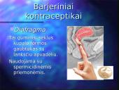 Kontraceptinės priemonės 12 puslapis