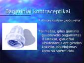 Kontraceptinės priemonės 13 puslapis