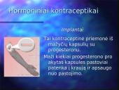Kontraceptinės priemonės 19 puslapis