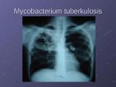 Mycobacterium gentis 18 puslapis