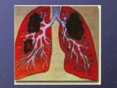 Mycobacterium gentis 19 puslapis