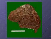 Mycobacterium gentis 20 puslapis