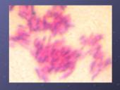 Mycobacterium gentis 5 puslapis